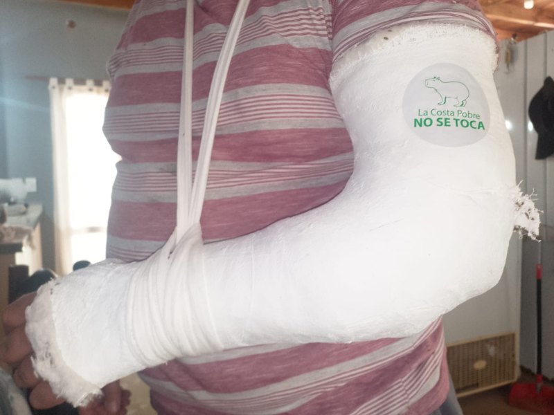 agresion costa pobre